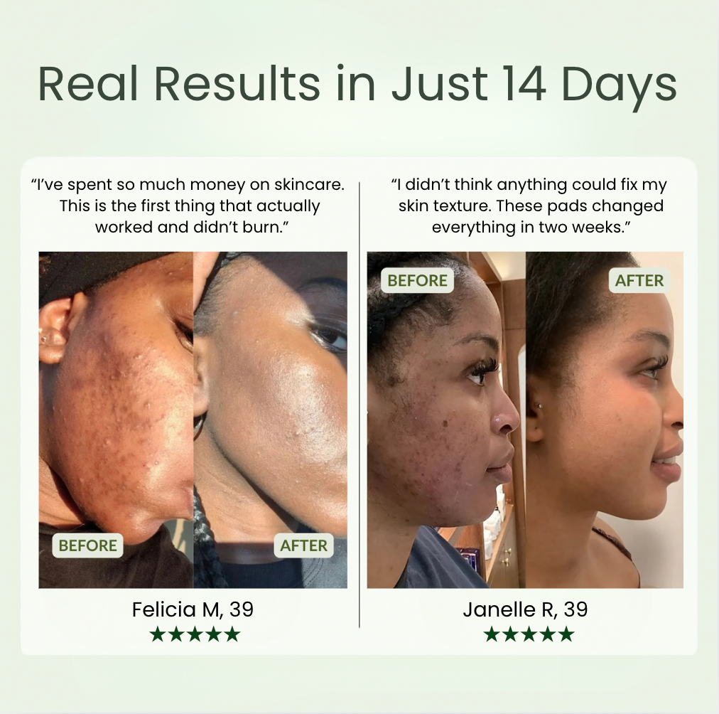 Jiyu Korean Anti-Aging Toner Pads