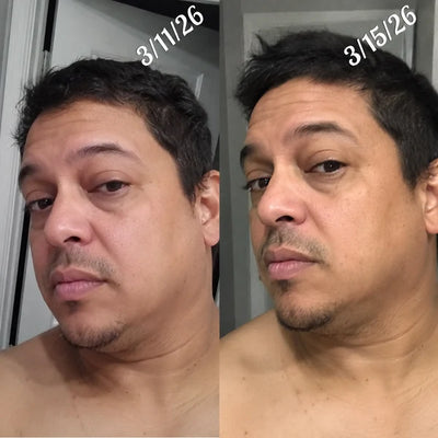 Lymphatic Drainage Drops